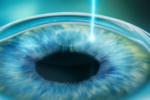 who-is-not-suitable-for-laser-eye-surgery