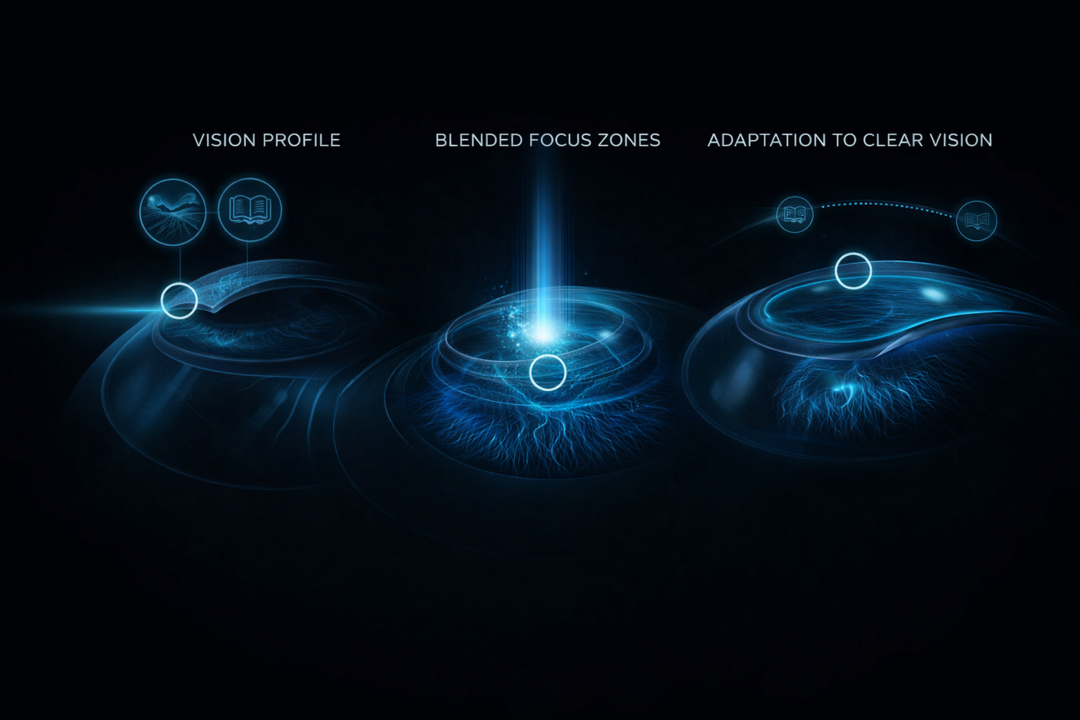 Presbyond laser blended vision diagram