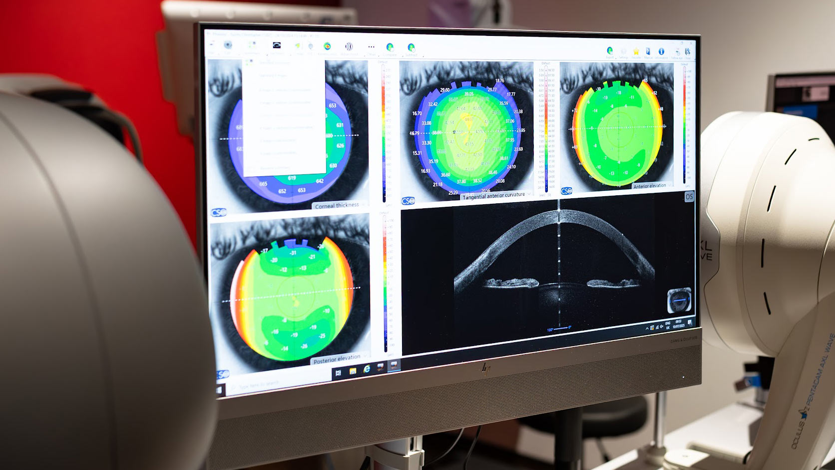 hyperopia-vs-myopia